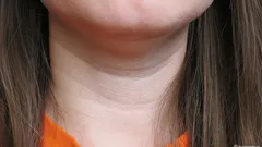 Okamžitě prozrazuje věk: jak se zbavit „Venušiny kroužky“ na krku